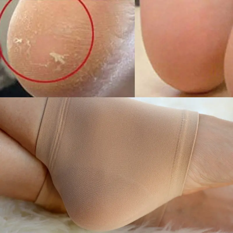 2Pcs Silicone Foot Care Moisturizing Gel Heel Socks Cracked Foot Skin Care Foot Protector For Women Men M 1